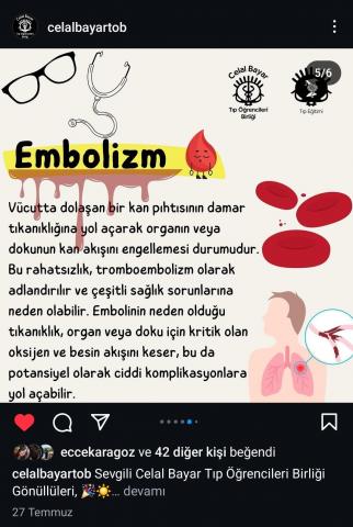 Embolizmin açıklandığı sayfa